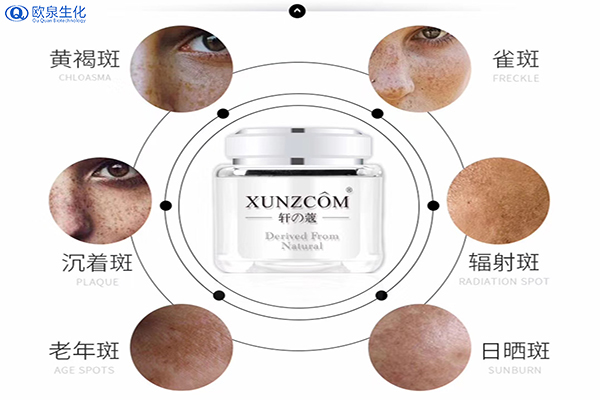如何有效祛斑？祛斑的關鍵是什么-歐泉生化